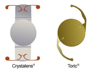 Crystalens and Toric Lens Implants