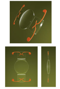 Trulign Toric Accommodating Intraocular Lenses